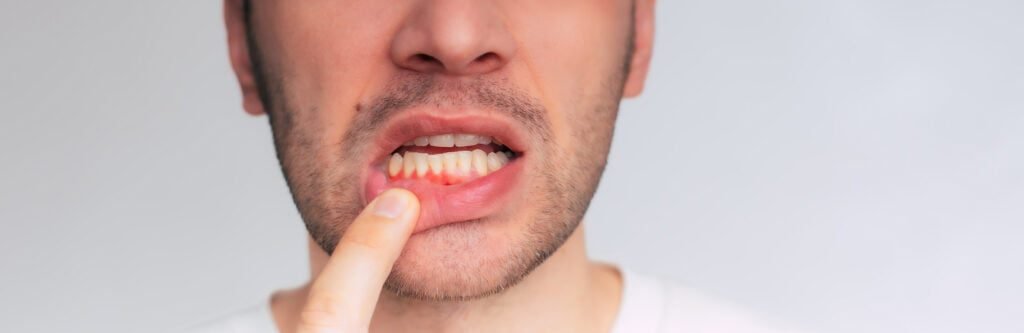 Aprende a cómo cuidar tus dientes y aplica estos 10 consejos prácticos cuidar tus encías