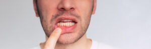 Aprende a cómo cuidar tus dientes y aplica estos 10 consejos prácticos cuidar tus encías