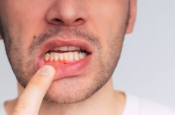 10 practical tips for healthy teeth gums