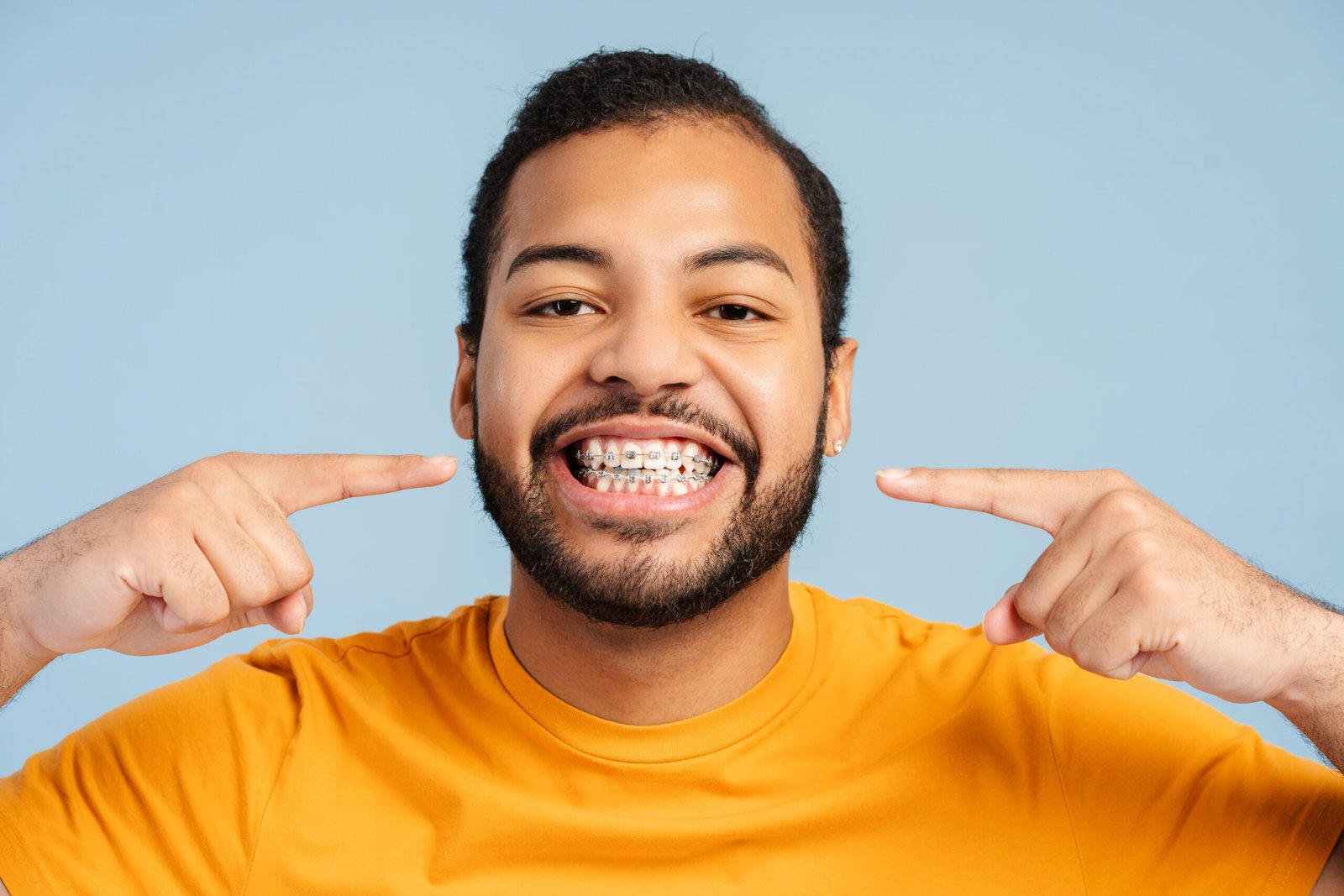 Ortodoncia qué es y como podría necesitarla para alinear tus dientes