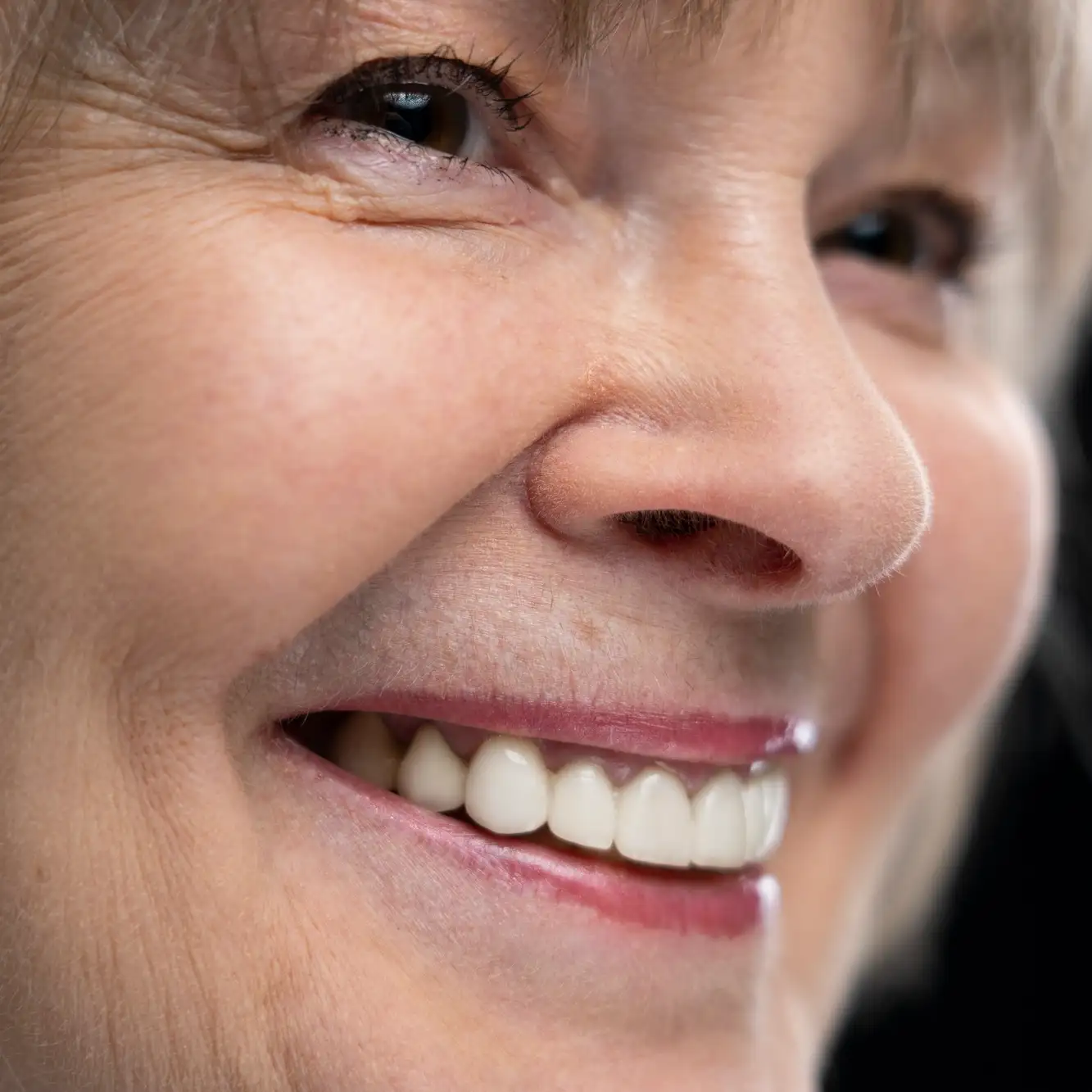 implantes dentales