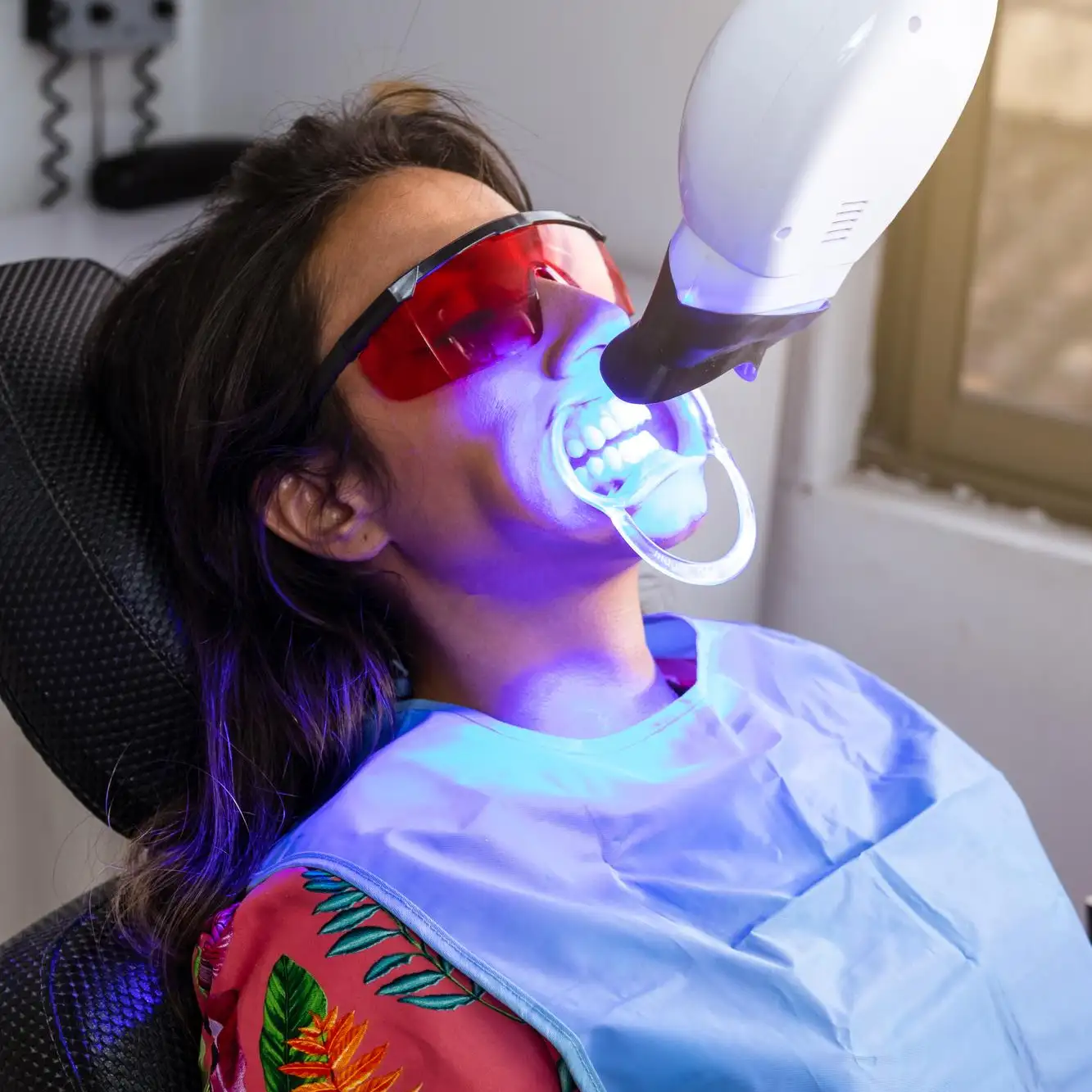 Blanqueamiento dental en consultorio
