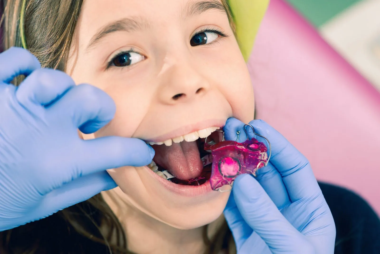 dental braces 798657 20168 1